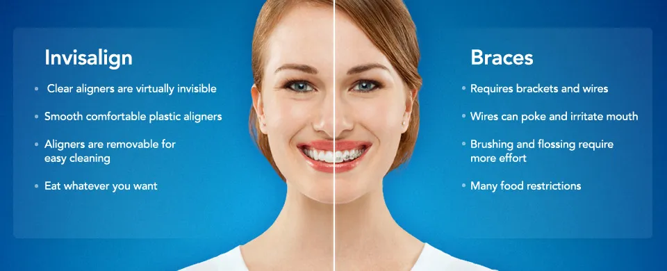 Invisalign Clear Braces San Rafael CA