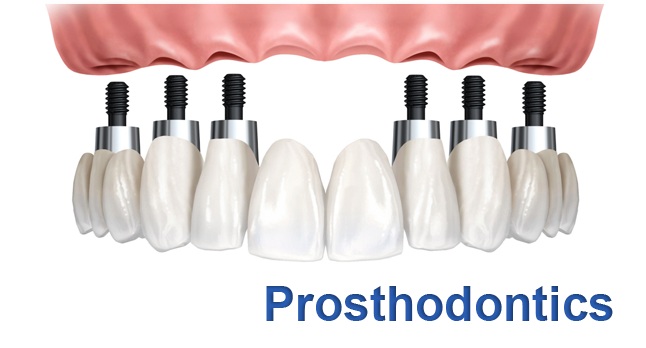 prosthodontics-img