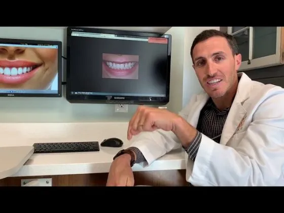 Why you should straighten teeth